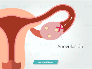 anovulacion.jpg