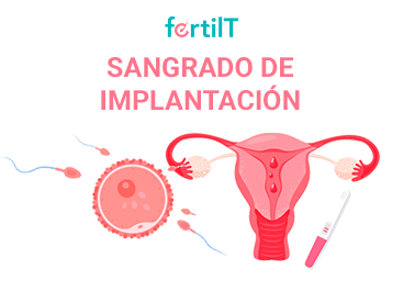 sangrado-de-implantacion-mini.png
