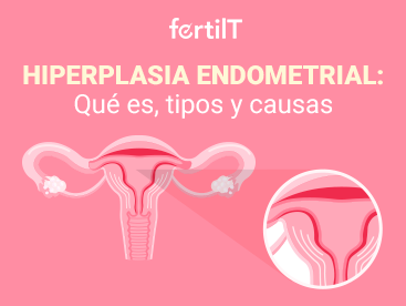 hiperplasia-endometrial-que-es-tipos-y-causas-portada-miniatura.png