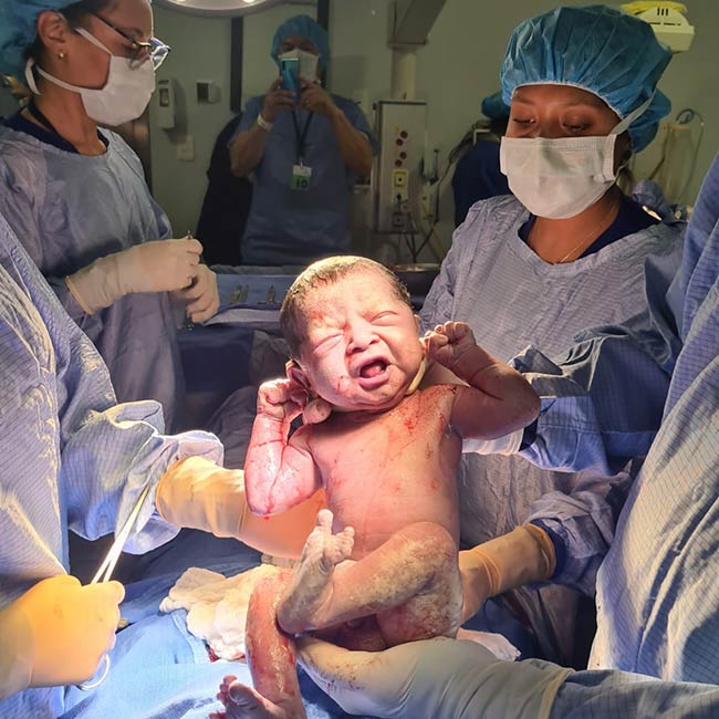 Bebe nacido por tratamiento de reproducción asistida